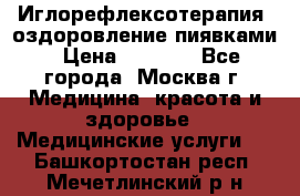 Иглорефлексотерапия, оздоровление пиявками › Цена ­ 3 000 - Все города, Москва г. Медицина, красота и здоровье » Медицинские услуги   . Башкортостан респ.,Мечетлинский р-н